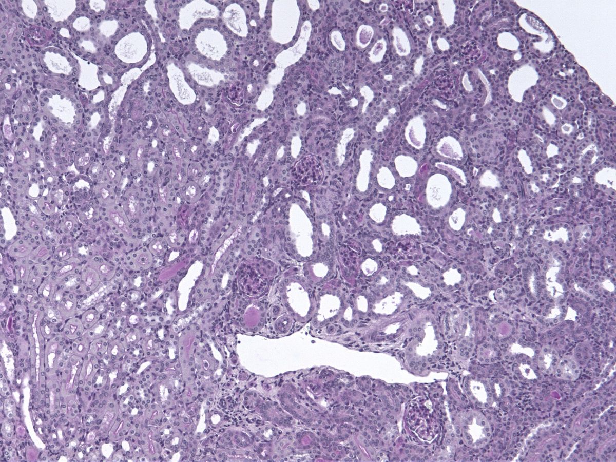 PAS staining adenine kidney