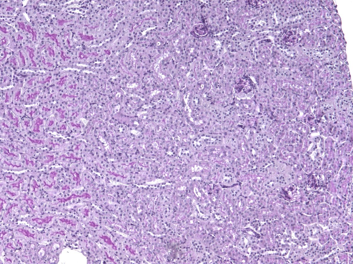 PAS staining normal kidney
