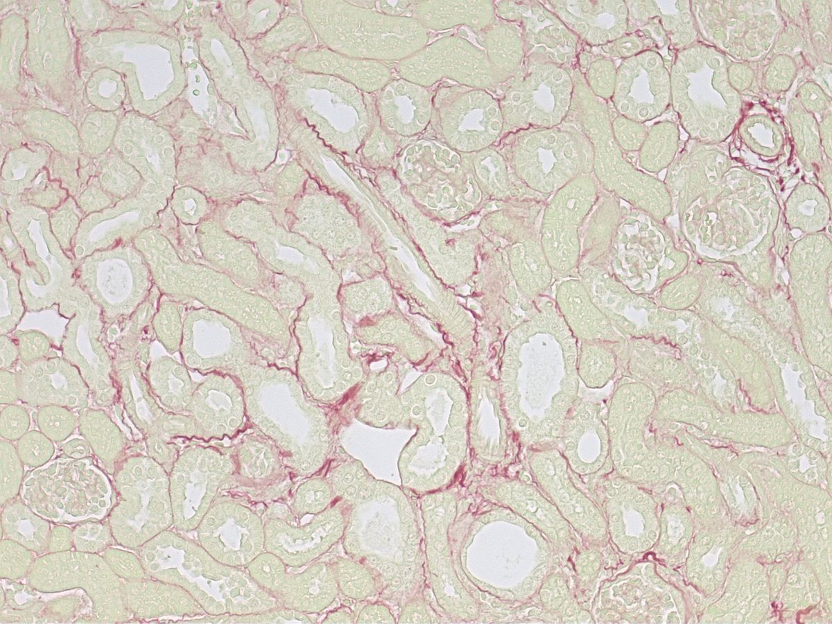 Sirius Red adenine kidney