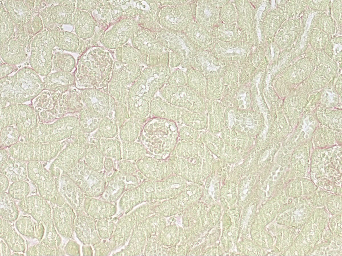 Sirius Red normal kidney